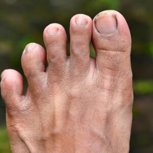 Is a longer second toe a sign of intelligence?