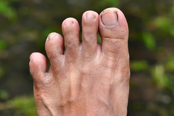 Is a longer second toe a sign of intelligence?