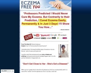 1741186902_eczemafree-x400-thumb.jpg Eczema Free You - How to Treat Eczema Easily, Naturally and For Good